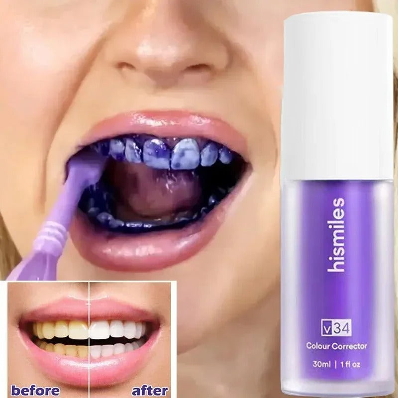 Hi Smile Teeth Serum