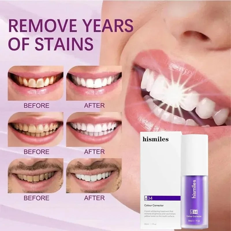 Hi Smile Teeth Serum