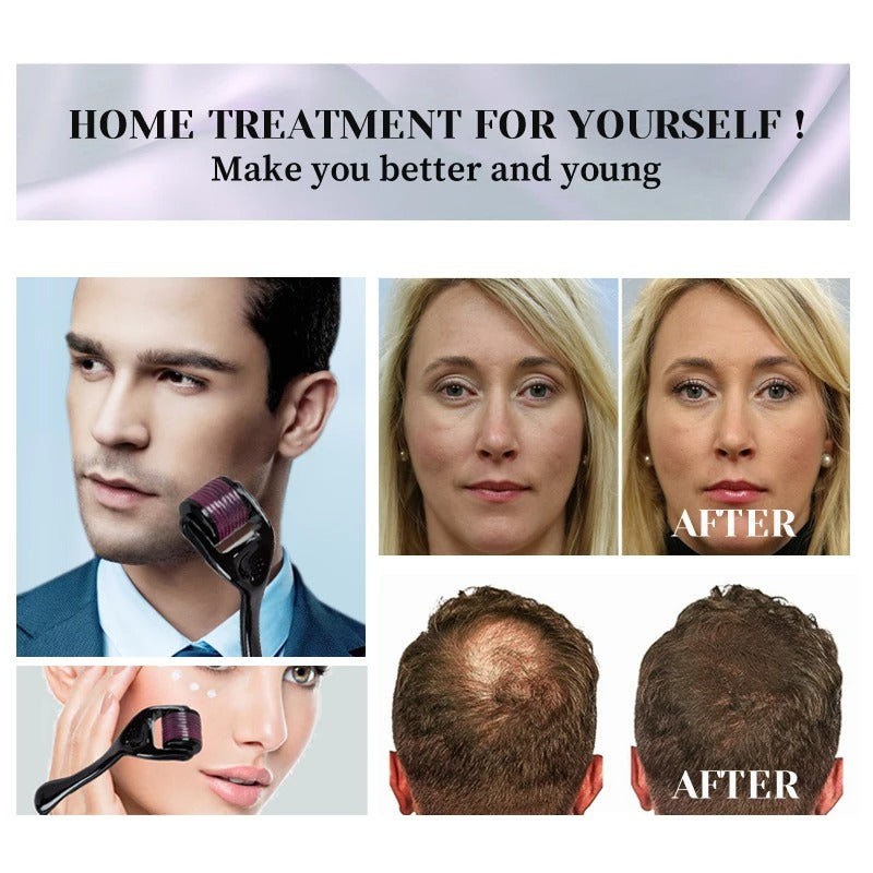 Derma Roller