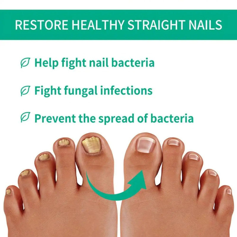Nail fungus remover