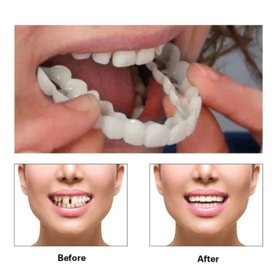 Smilly Fake Teeth