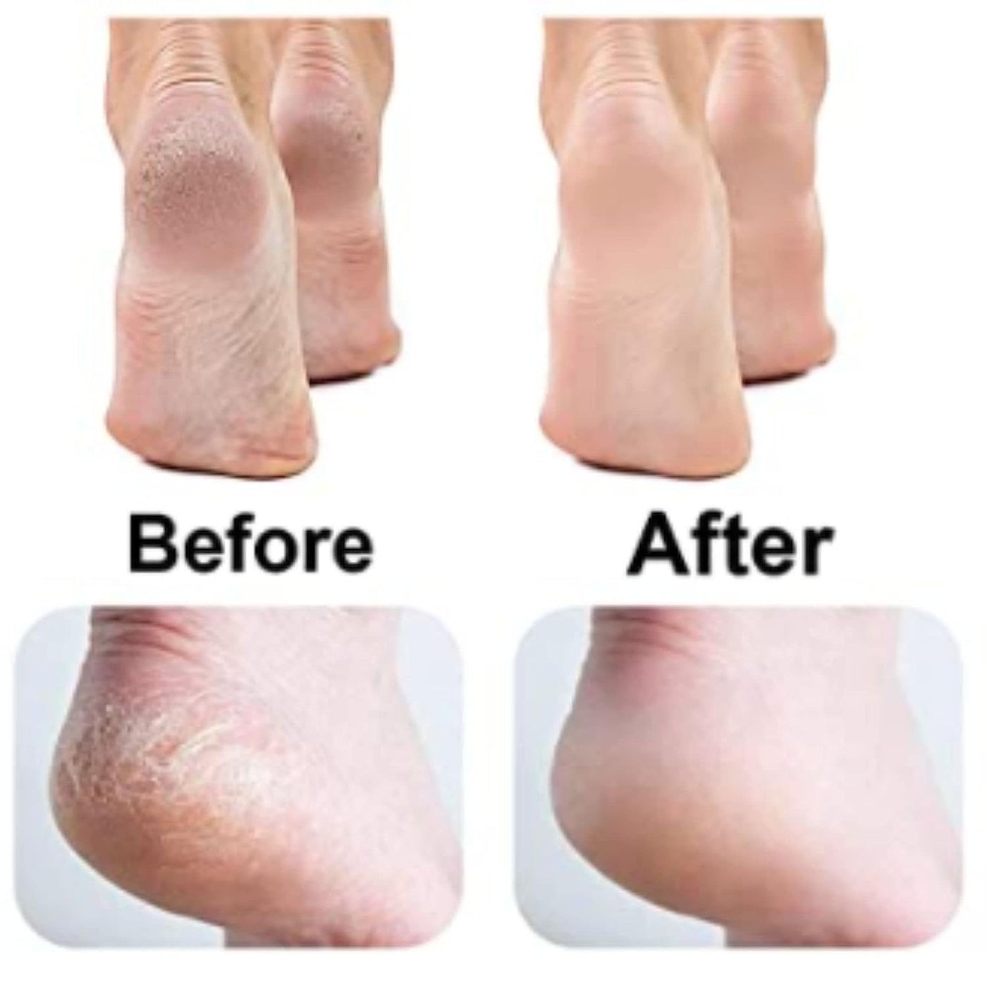 Dead Skin Removal Electronic Foot Filer