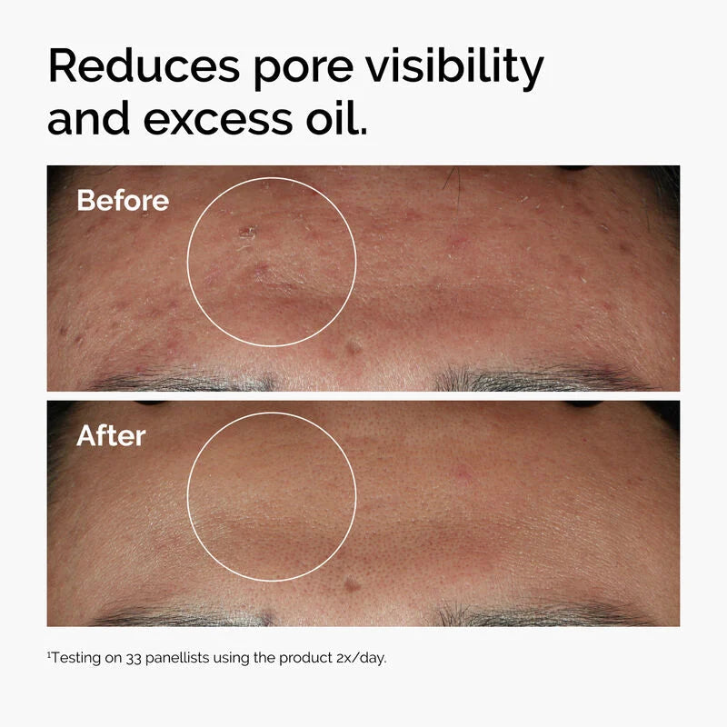 The Ordinary Niacinamide 10% + Zinc 1% Serum - 30ml