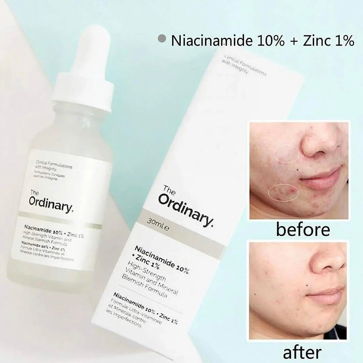 The Ordinary Niacinamide 10% + Zinc 1% Serum - 30ml