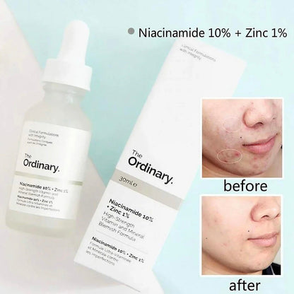 The Ordinary Niacinamide 10% + Zinc 1% Serum - 30ml