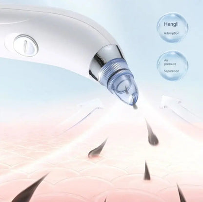 Facial Beauty - Electric Vaccum Derma Suction Blackheads Remover