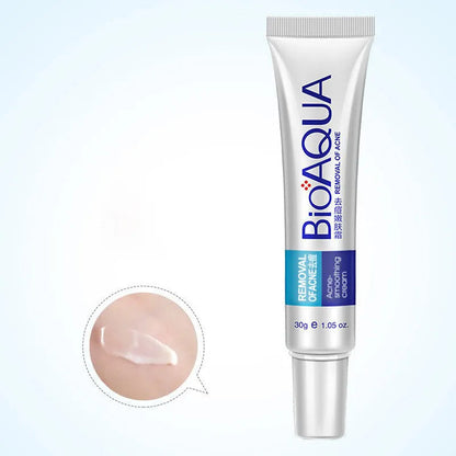 Bioaqua - Anti Acne Scar Removal Cream 30g