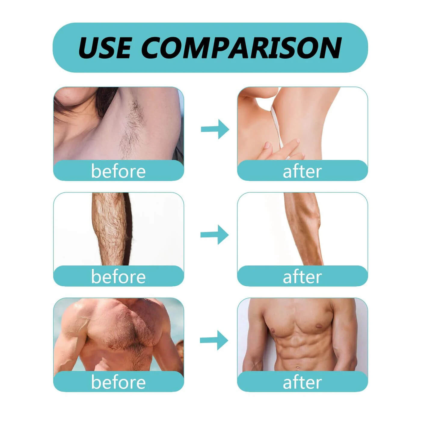Ecrin Hair Removal Spray For Men & Women - 150ml