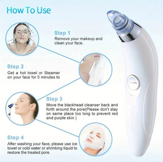Facial Beauty - Electric Vaccum Derma Suction Blackheads Remover