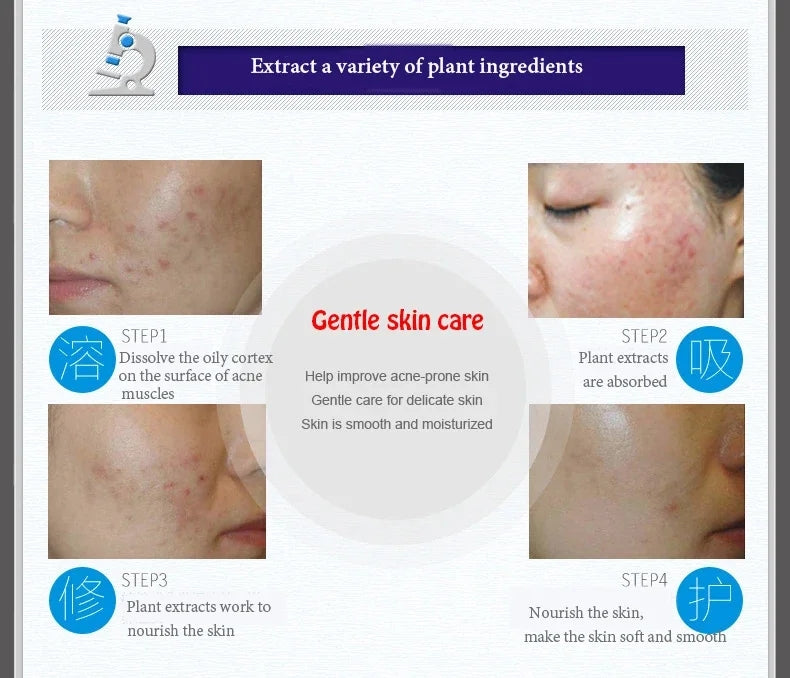 Bioaqua Acni cream